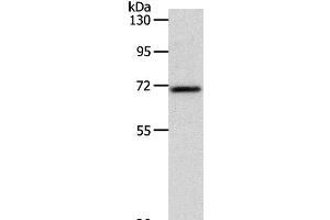 Western Blot analysis of Mouse liver tissue using SOX-13 Polyclonal Antibody at dilution of 1:800 (SOX13 anticorps)