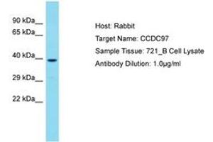 Image no. 1 for anti-Coiled-Coil Domain Containing 97 (CCDC97) (C-Term) antibody (ABIN6750718) (CCDC97 anticorps  (C-Term))