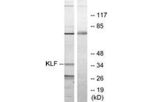 Western blot analysis of extracts from Jurkat cells, treated with serum 20% 15', using KLF Antibody. (KLF anticorps  (AA 291-340))