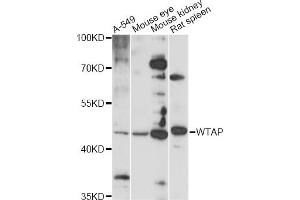 Western blot analysis of extracts of various cell lines, using WTAP antibody (ABIN6291068) at 1:1000 dilution. (WTAP anticorps)