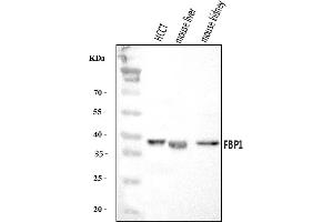 Western blot analysis of FBP1 using anti-FBP1 antibody (ABIN7599395).