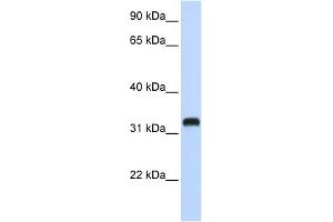 WB Suggested Anti-C21orf62 Antibody Titration:  0. (C21orf62 anticorps  (Middle Region))