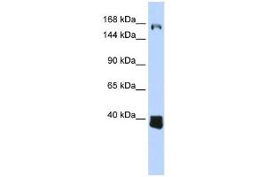 C10ORF12 antibody used at 1 ug/ml to detect target protein. (Lcor anticorps  (Middle Region))