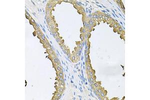Immunohistochemistry of paraffin-embedded human prostate using ABL1 antibody. (ABL1 anticorps)