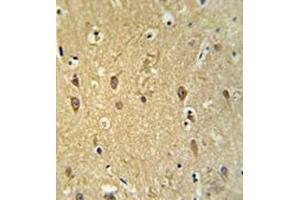 Immunohistochemistry analysis in brain tissue (formalin-fixed, paraffin-embedded) using GPR17 Antibody , followed by peroxidase conjugation of the secondary antibody and DAB staining.
