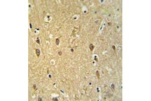 Immunohistochemistry analysis in brain tissue (formalin-fixed, paraffin-embedded) using GPR17 Antibody , followed by peroxidase conjugation of the secondary antibody and DAB staining. (GPR17 anticorps  (Middle Region))