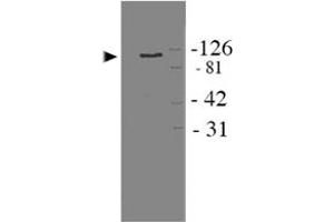 Western blot analysis of Apbb1 in HEK 293 cell lysate using Apbb1 polyclonal antibody . (FE65 anticorps)