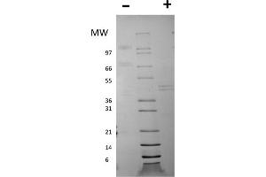 SDS-PAGE of Mouse Interleukin-12 Recombinant Protein SDS-PAGE of Mouse Interleukin-12 Recombinant Protein.