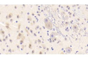 Detection of LDLRAP1 in Mouse Cerebrum Tissue using Polyclonal Antibody to Low Density Lipoprotein Receptor Adaptor Protein 1 (LDLRAP1)