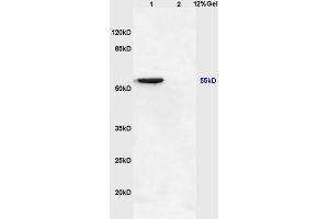 Lane 1: mouse brain lysates Lane 2: mouse heart lysates probed with Anti NFKBIE/IKB epsilon Polyclonal Antibody, Unconjugated (ABIN1386753) at 1:200 in 4 °C. (NFKBIE anticorps  (AA 165-270))