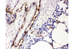 IHC analysis of VWF using anti-VWF antibody (ABIN3042349). (VWF anticorps  (AA 1304-1452))