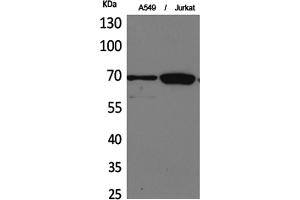 Western Blotting (WB) image for anti-X-Ray Repair Complementing Defective Repair in Chinese Hamster Cells 6 (XRCC6) (Lys539) antibody (ABIN5960010)