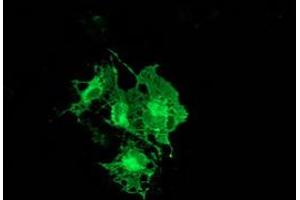 Immunofluorescence (IF) image for anti-Protein Kinase C, epsilon (PRKCE) antibody (ABIN1500229)