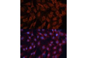 Immunofluorescence analysis of C6 cells using DN antibody (ABIN6130336, ABIN6139701, ABIN6139702 and ABIN7101774) at dilution of 1:100. (DNAJB1 anticorps  (AA 1-340))