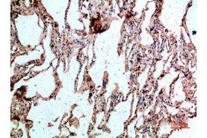 Immunohistochemical analysis of paraffin-embedded human-lung, antibody was diluted at 1:200