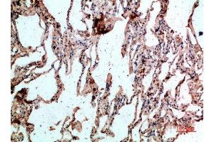 Immunohistochemical analysis of paraffin-embedded human-lung, antibody was diluted at 1:200 (CD236/GYPC anticorps  (AA 11-60))