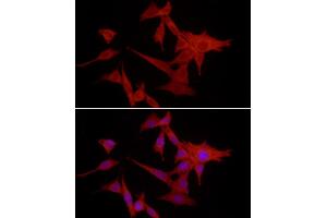 Immunofluorescence analysis of NIH/3T3 cells using S100 Rabbit pAb (ABIN3015803, ABIN3015804, ABIN3015805, ABIN1682607 and ABIN6219148) at dilution of 1:50 (40x lens).