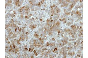 IHC-P Image Immunohistochemical analysis of paraffin-embedded MCF7 xenograft, using TBCK, antibody at 1:100 dilution. (TBCK anticorps)