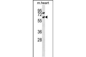Western blot analysis in mouse heart tissue lysates (35ug/lane). (ACVR1C/ALK7 anticorps  (C-Term))