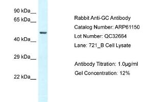 Western Blotting (WB) image for anti-Gc (N-Term) antibody (ABIN2788696) (Gc (N-Term) anticorps)
