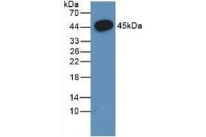 Detection of Recombinant FSHb, Porcine using Polyclonal Antibody to Follicle Stimulating Hormone Beta (FSHb)