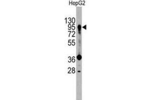 Western Blotting (WB) image for anti-Prospero Homeobox 1 (PROX1) antibody (ABIN3001422) (PROX1 anticorps)