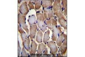 Immunohistochemistry analysis in Formalin Fixed, Paraffin Embedded Human skeletal muscle tissue stained with SEPN1 antibody (C-term) followed by peroxidase conjugation of the secondary antibody and DAB staining. (SEPN1 anticorps  (C-Term))