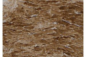 ABIN6272860 at 1/100 staining Rat heart tissue by IHC-P. (PFKFB3 anticorps  (C-Term))