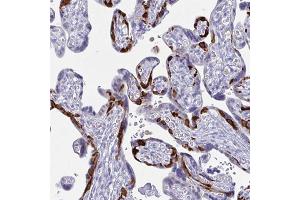Immunohistochemical staining of human placenta with PEG10 polyclonal antibody  shows strong cytoplasmic positivity in a subset of trophoblastic cells.