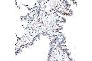 Immunohistochemistry of paraffin-embedded rat lung using CoREST/RCOR1 Rabbit mAb (ABIN7269920) at dilution of 1:100 (40x lens).