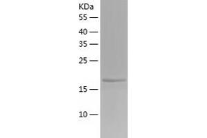 Western Blotting (WB) image for PR Domain Containing 2, with ZNF Domain (PRDM2) (AA 2-200) protein (His-IF2DI Tag) (ABIN7124542)