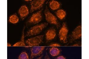Immunofluorescence analysis of HeLa cells using MTMR9 Polyclonal Antibody at dilution of 1:100.