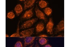 Immunofluorescence analysis of HeLa cells using MTMR9 Polyclonal Antibody at dilution of 1:100. (MTMR9 anticorps)