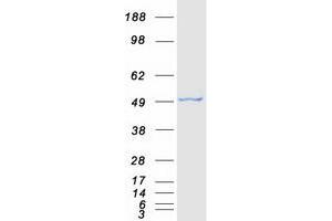 Validation with Western Blot