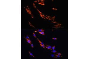 Immunofluorescence analysis of NIH/3T3 cells using  Rabbit pAb (ABIN6134011, ABIN6136599, ABIN6136600 and ABIN6224718) at dilution of 1:100.