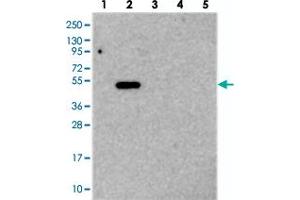 Western blot analysis of Lane 1: RT-4, Lane 2: U-251 MG, Lane 3: Human Plasma, Lane 4: Liver, Lane 5: Tonsil with TMEM39A polyclonal antibody  at 1:250-1:500 dilution. (TMEM39A anticorps)