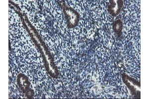 Image no. 2 for anti-Ubiquitin-Conjugating Enzyme E2E 3 (UBE2E3) antibody (ABIN1501618)