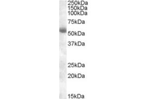 Western Blotting (WB) image for anti-Transmembrane Protease, serine 2 (TMPRSS2) (Internal Region) antibody (ABIN2466752) (TMPRSS2 anticorps  (Internal Region))