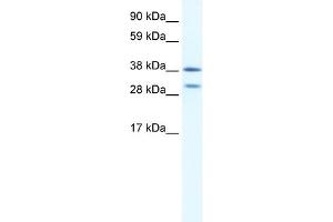 WB Suggested Anti-NKX2-3 Antibody Titration:  0. (NK2 Homeobox 3 anticorps  (N-Term))