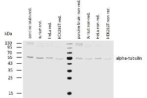 Western blotting analysis of human alpha-tubulin using mouse monoclonal antibody TU-16 on lysates of various cell lines and porcine brain under reducing and non-reducing conditions.