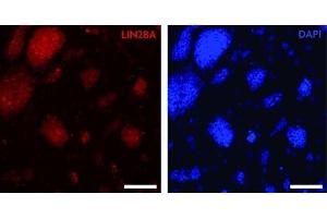 Immunocytochemical analysis of LIN28A staining of mouse embryonic stem cells.