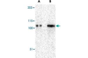 Western blot analysis of TRPC6 in K-562 cell lysate with TRPC6 polyclonal antibody  at (A) 0.