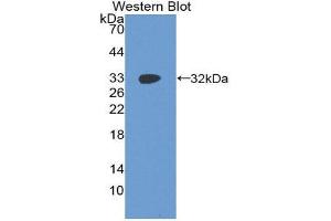 Western Blotting (WB) image for anti-Insulin-Like Growth Factor 2 mRNA Binding Protein 2 (IGF2BP2) (AA 141-384) antibody (ABIN1859297) (IGF2BP2 anticorps  (AA 141-384))