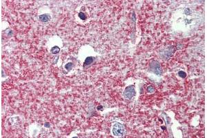 Human Brain, cortex: Formalin-Fixed, Paraffin-Embedded (FFPE) (SHROOM2 anticorps  (AA 1554-1616))