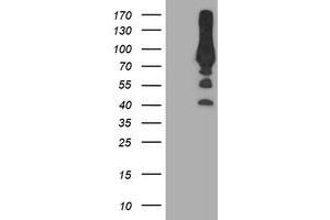 Western Blotting (WB) image for anti-phosphofructokinase, Platelet (PFKP) antibody (ABIN1500165) (PFKP anticorps)