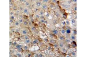 Used in DAB staining on fromalin fixed paraffin-embedded liver tissue