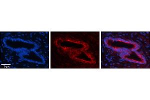 Rabbit Anti-SLBP Antibody     Formalin Fixed Paraffin Embedded Tissue: Human Bronchial Epithelial Tissue  Observed Staining: Cytoplasmic  Primary Antibody Concentration: 1:100  Secondary Antibody: Donkey anti-Rabbit-Cy3  Secondary Antibody Concentration: 1:200  Magnification: 20X  Exposure Time: 0.