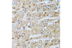 Immunohistochemistry of paraffin-embedded rat brain using ENO2 antibody (ABIN5971596) at dilution of 1/100 (40x lens). (ENO2/NSE anticorps)