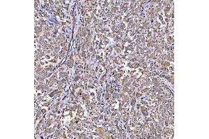 IHC analysis of RAB3GAP1 using anti-RAB3GAP1 antibody (ABIN7599702). (RAB3GAP1 anticorps  (AA 109-810))