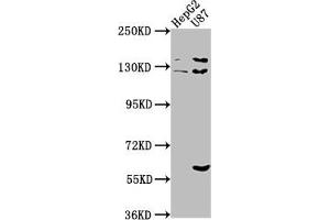 Western Blot Positive WB detected in: HepG2 whole cell lysate, U87 whole cell lysate All lanes: ST5 antibody at 1:2000 Secondary Goat polyclonal to rabbit IgG at 1/50000 dilution Predicted band size: 127, 83, 71 kDa Observed band size: 127 kDa (ST5 anticorps  (AA 3-280))